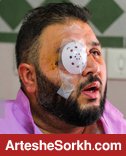 هوادار پرسپولیس: چشمم نمی بیند اما یک عذرخواهی ساده هم نکردند!
